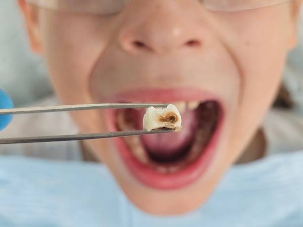 Best Broken or Chipped Tooth Repair in Cicero, IL